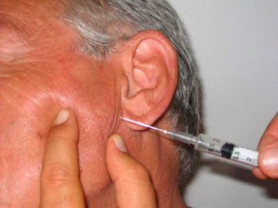 Sialorrea o salivación excesiva en la enfermedad de Parkinson: cuando