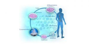 terapia celular para la esclerosis lateral amiotrófica