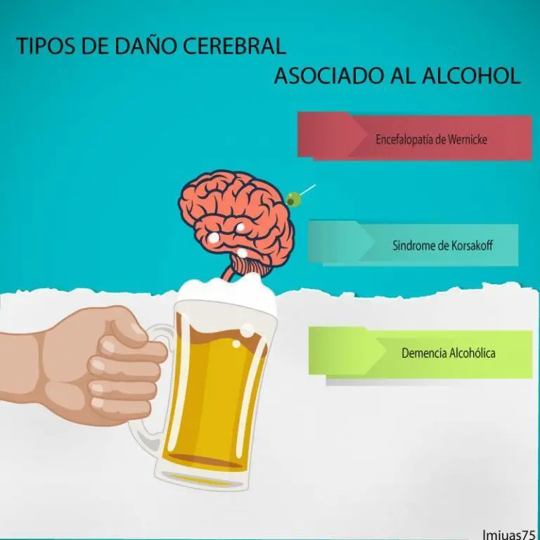alcohol, salud cerebral y demencia