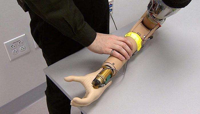prótesis de brazo basadas en interfaces neuronales