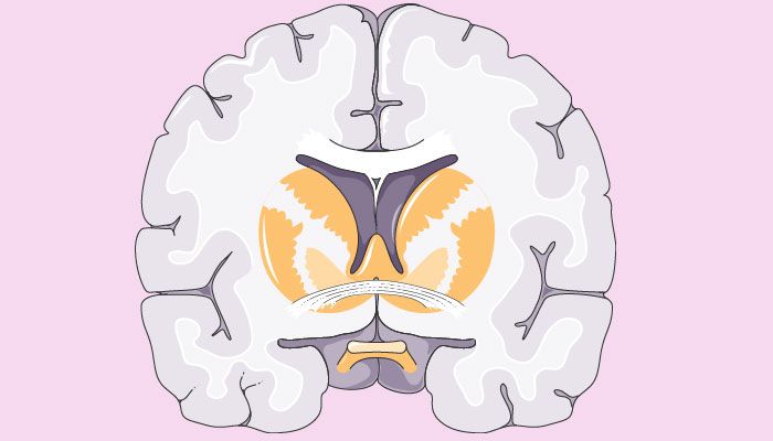 edema cerebral tipos