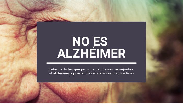 alzheimer diagnostico diferencial