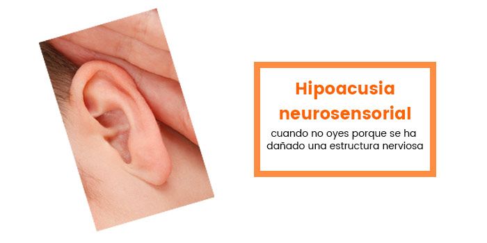 hipoacusia neurosensorial