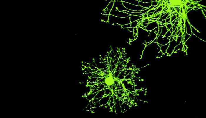 Resultado de imagen de Neuronas, impulsos eléctricos, nervios y conexiones sin din"