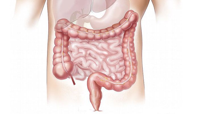 colon intestino