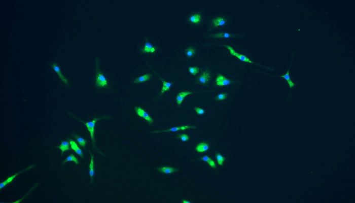 En verde, la microglía. Crédito de imagen: National Institute of Allergy and Infectious Diseases/NIH