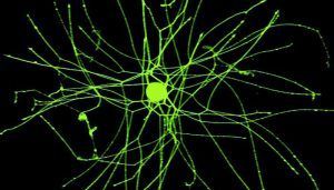 neuronas sensoriales