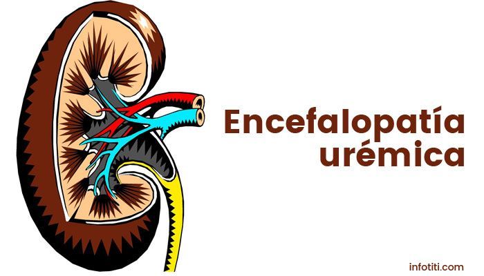 Encefalopatía urémica: síntomas y de