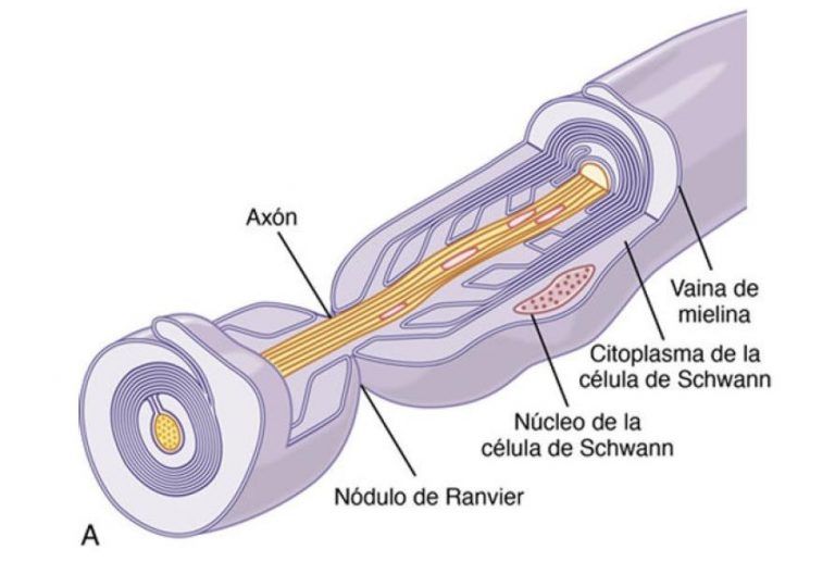 Fisiopatología de la esclerosis múltiple: qué sucede cuando se une el