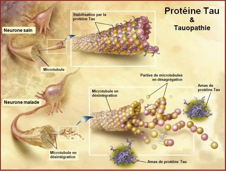 La Proteína Tau: Qué Es Y Cómo Influye En El Alzhéimer Y Otras ...